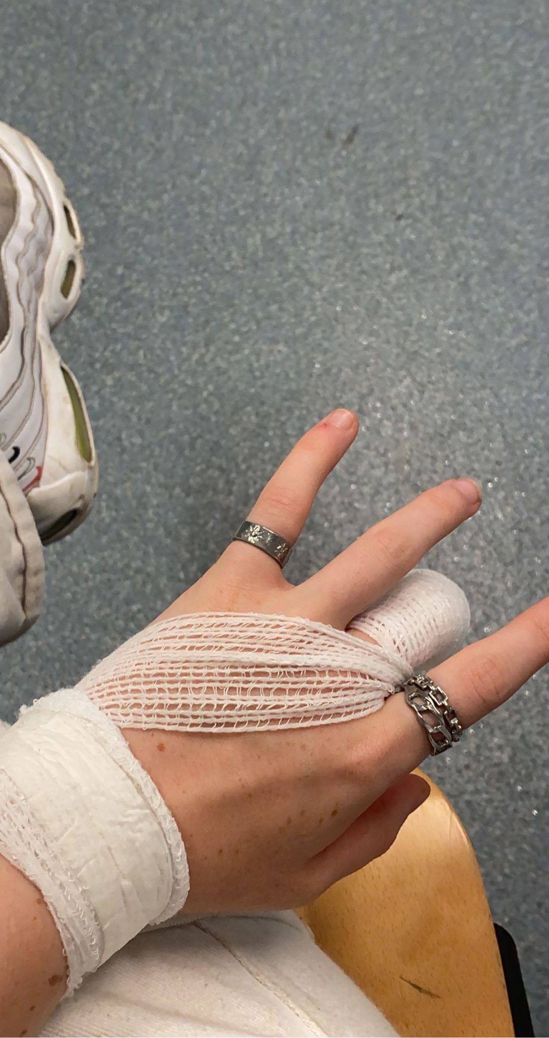 Summer Gibbs seen escorted by Reading Festival staff after injuring her finger