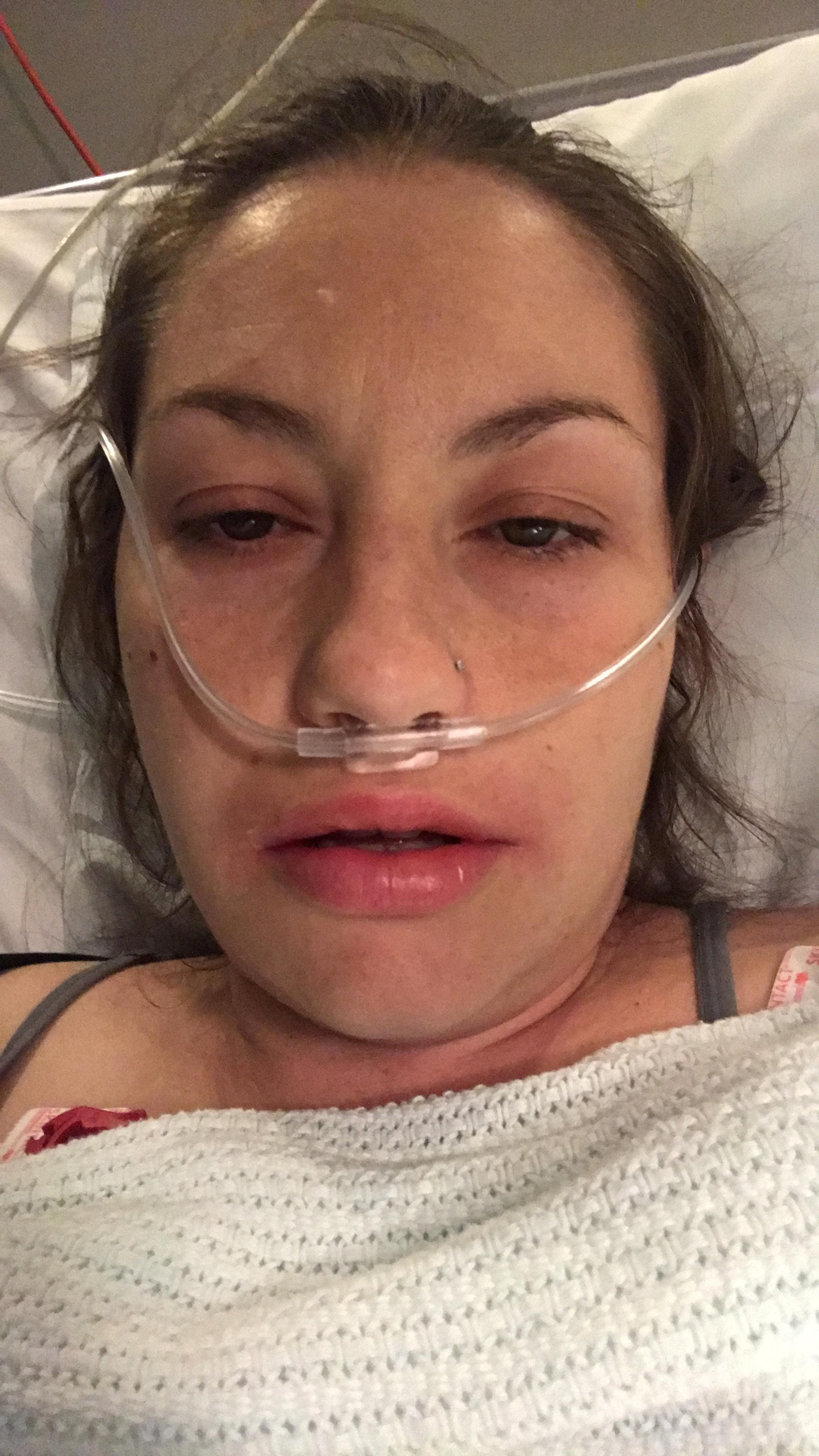 Shelly Young in hospital. See SWNS story SWBRsepsis; A mum left fighting for her life from an infection developed after giving birth is calling for lessons to be learned following NHS failures to recognize symptoms of sepsis. Shelly Young, 33, was